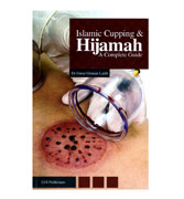 Islamic Cupping & Hijamah: A Complete Guide