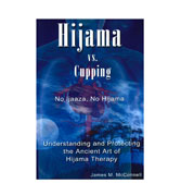 Hijama vs. Cupping : No Ijaaza, No Hijama